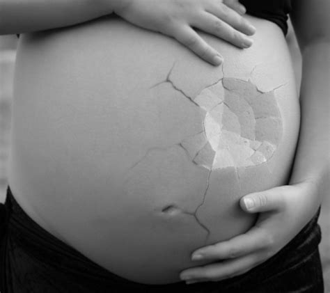 Principales causas del aborto espontáneo – DRUNCHA [NOTICIAS & BLOG]