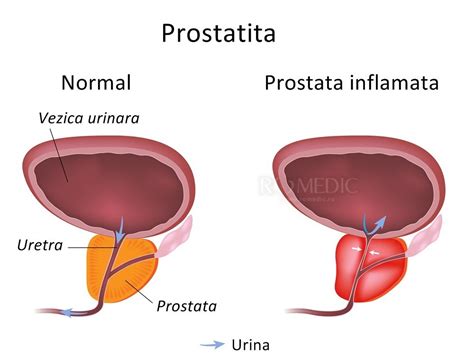 Prostata | Anatomie si fiziologie