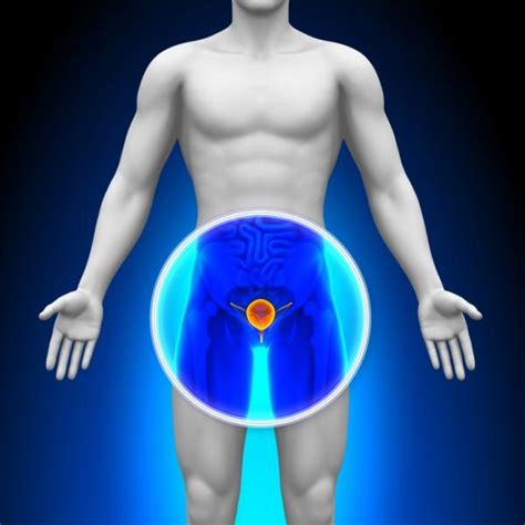 Prostatitis aguda: síntomas, causas y tratamiento
