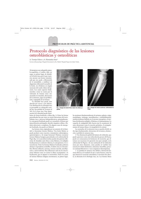 Protocolo diagnóstico de las lesiones osteoblásticas