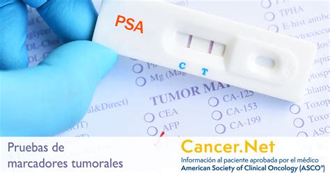 Pruebas de marcadores tumorales | Cancer.Net