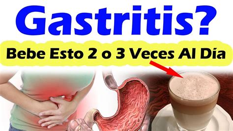 QUE ES BUENO PARA LA GASTRITIS Remedios Caseros Para La Gastritis Que ...