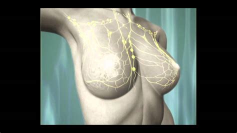 ¿Qué es el cáncer de mama? YouTube
