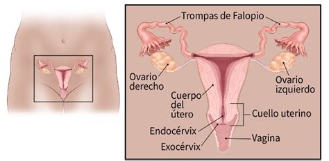 ¿Qué es el cáncer de ovario?