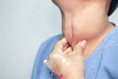 ¿Qué es el cáncer de tiroides?   Mejor con Salud
