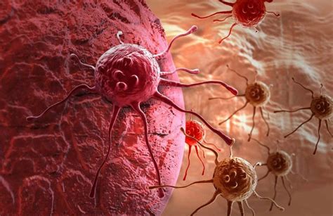 ¿Qué es el cáncer y cómo se expande por el organismo ...