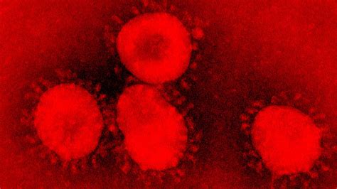 ¿Qué es el coronavirus? Síntomas, contagio y prevención ...