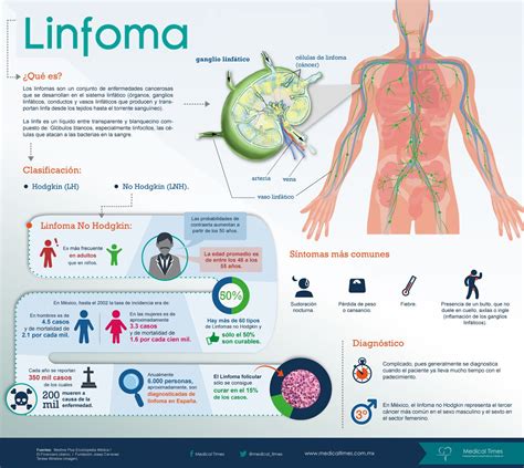 ¿Qué es el linfoma?   Investigación y Desarrollo | Salud ...