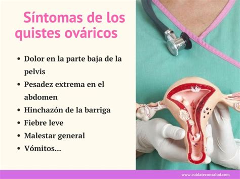Quistes en los Ovarios ⇒ 【↓Síntomas y Tratamiento↓】