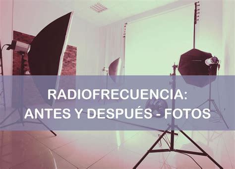 Radiofrecuencia Antes y Después    ¡¡¡Todas Las Fotos!!!