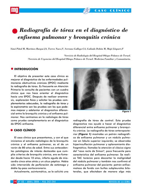 Radiografía de tórax en el diagnóstico de enfisema pulmonar y