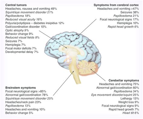 Ranked tumor symptoms by anatomical region in the brain ...