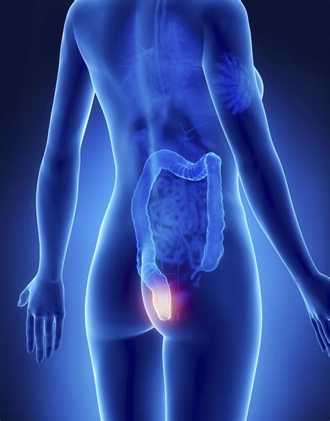Rectal Cancer: Symptoms, Causes, Diagnosis, and Treatment