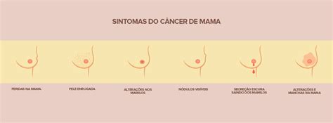 Rede Odonto | Câncer de mama: conheça os sintomas ...