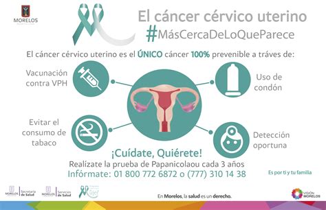 Refuerzan campaña permanente contra el cáncer cervicouterino ...