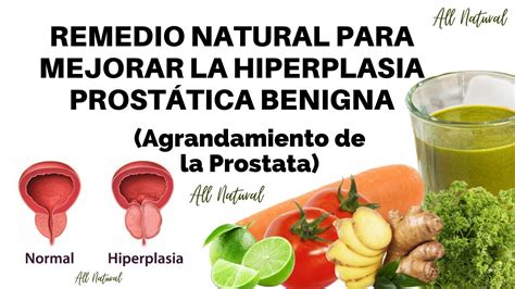 Remedio Natural para Mejorar la Hiperplasia Prostática Benigna   YouTube
