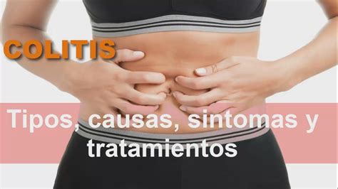Remedios caseros para la colitis: Colitis Ulcerosa | Causas de la ...