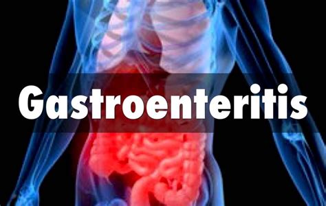 Remedios caseros para la gastroenteritis o gripe del estómago – Como ...