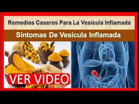 Remedios Caseros Para La Vesicula Inflamada, Sintomas De ...