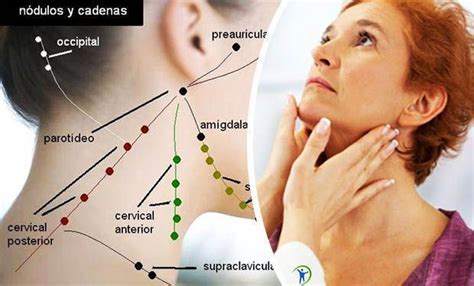 remedios caseros para los ganglios inflamados en el cuello | Medicine ...