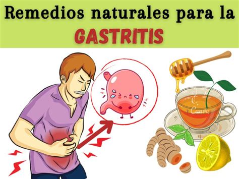 Remedios naturales para la gastritis – Todo en la red