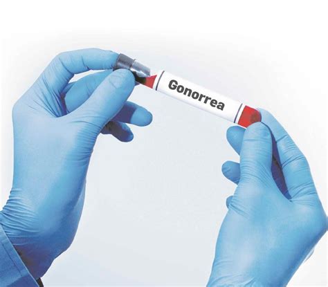 Resistente la gonorrea a los antibióticos | El Nuevo Día