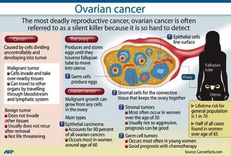 ROCA Ovarian Cancer Test for Early Detection | Cancer Biology
