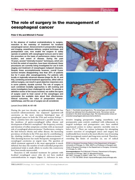 Rol de La Cirugia Cancer de Esofago | Esophageal Cancer ...