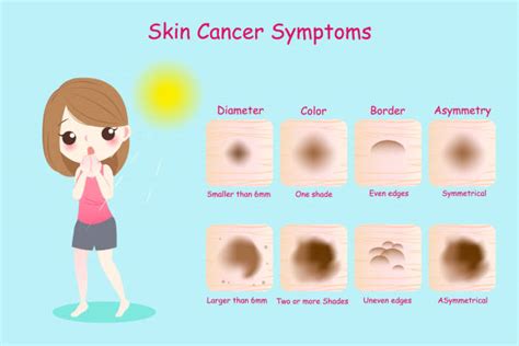Royalty Free Skin Cancer Clip Art, Vector Images ...