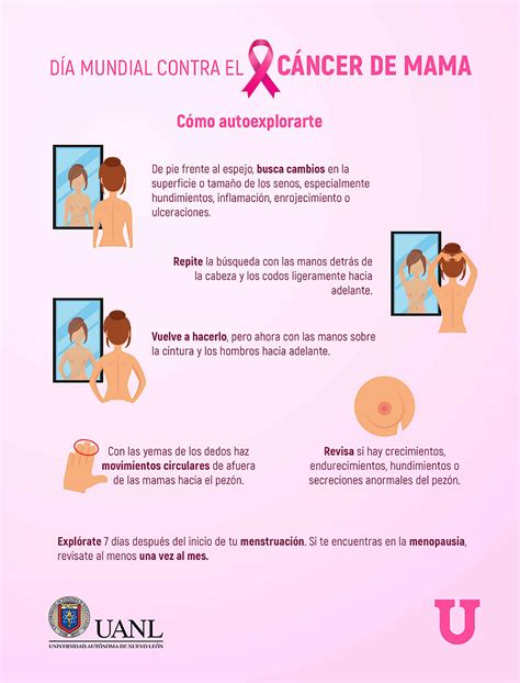 ¿Sabes cómo se detecta el cáncer de mama?   Punto U ...
