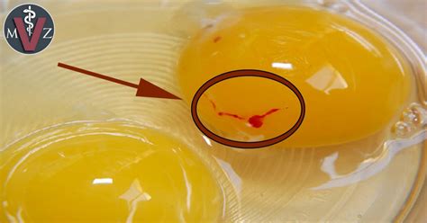 Sangre en los huevos de gallina   Médico Veterinario ...