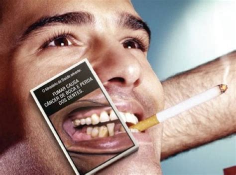SBOC faz alerta sobre o Câncer de Boca no Dia Mundial Sem Tabaco