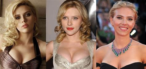 Scarlett Johansson Plastic Surgery Before and After Pictures 2022