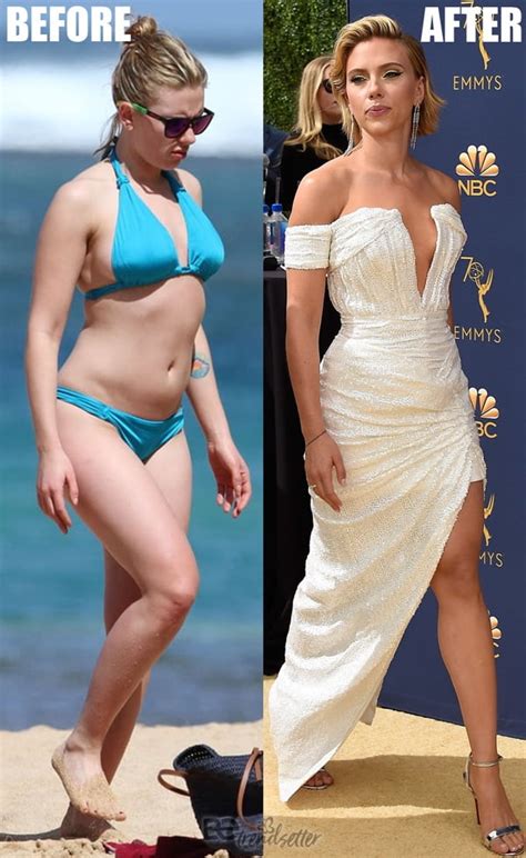 Scarlett Johansson Plastic surgery: Breast Reduction Before & After