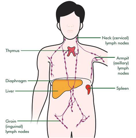 Secondary cancer in the lymph nodes   Cancer Information ...