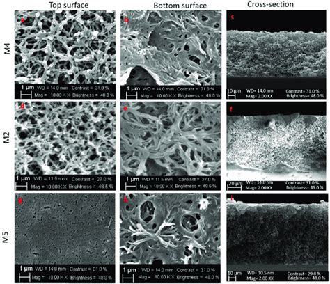 SEM images: top surface and bottom surface of membranes M4 ...