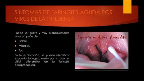 Semiología de faringitis y amigdalitis