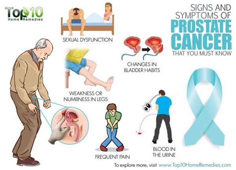 Signs and Symptoms of Prostate Cancer that You Must Know ...