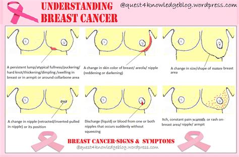 signs & symptoms of breast cancer | quest 4 knowledge blog