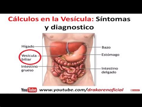 Sintomas Calculos En La Vesicula   SEONegativo.com