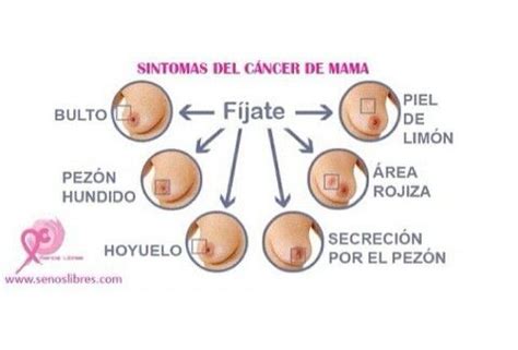 Sintomas cancer de mama ~ Ʀεƥɪииεð вƴ╭•⊰  Ʀσxʌиʌ Ƭʌиʌ ...