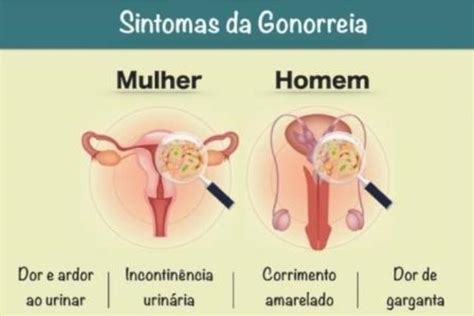 Sintomas da Gonorreia em homens e mulheres | SaúdeSublime