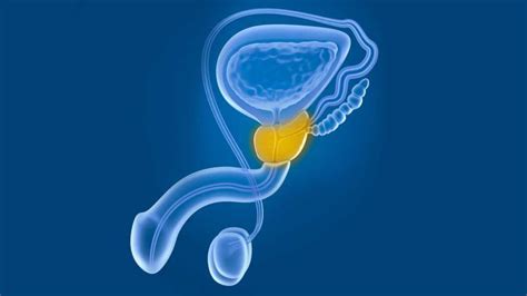 Sintomas da próstata Inflamada   Dr Gotardo Zini   Urologista