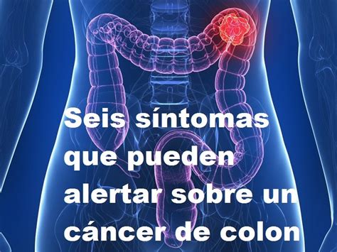 Síntomas de cáncer de colon ⊛ ¡Prevención y Tratamiento 2020!