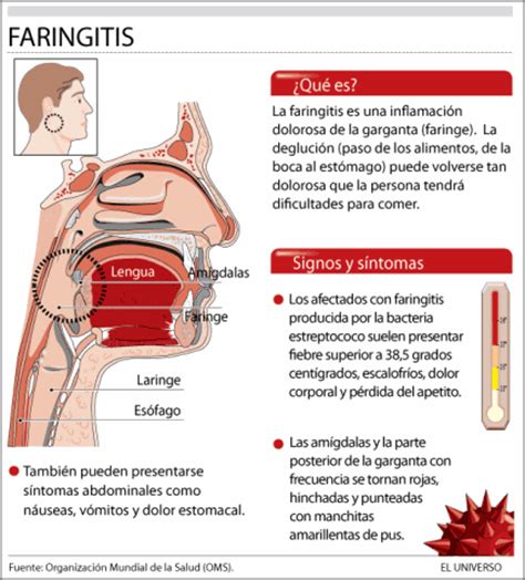 Sintomas de Faringitis   Taringa!