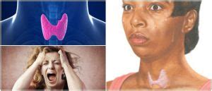Síntomas De Hipertiroidismo: ¿Qué Es La Tiroides? y ...