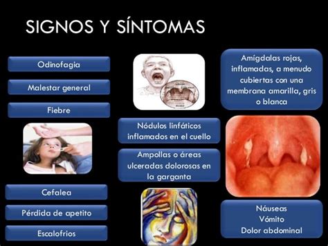 Síntomas de la amigdalitis: signos, causas, bacteriana y más