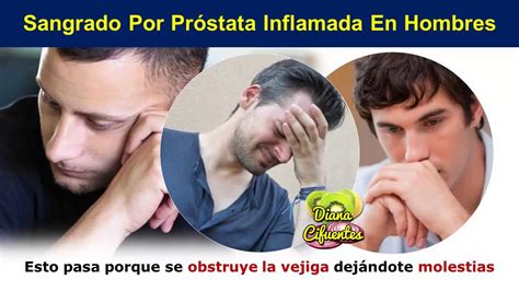 Sintomas De Prostata Inflamada En Hombres   YouTube