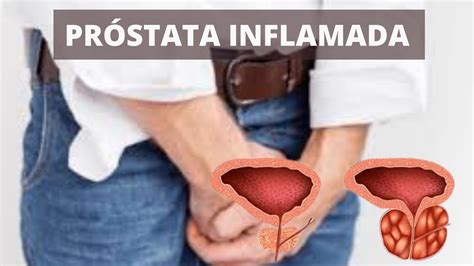 Sintomas de uma Próstata inflamada?