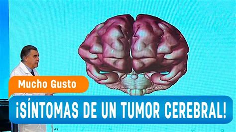 Síntomas de un tumor cerebral   Mucho Gusto 2018   YouTube